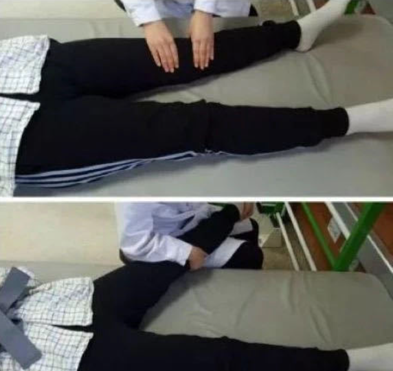 膝過伸不煩惱，康復訓練有妙招